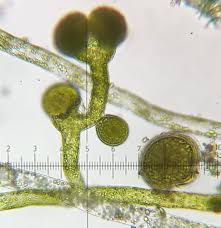 Attēlu rezultāti vaicājumam “Oligonema persimile spores”