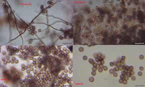 Attēlu rezultāti vaicājumam “Didymium clavus spores”