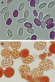 Attēlu rezultāti vaicājumam “Badhamia affinis var. microspora spores”