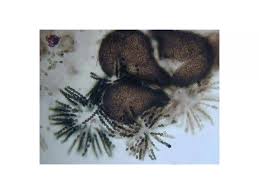 Attēlu rezultāti vaicājumam “Sordaria fimicola”