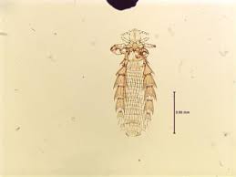Attēlu rezultāti vaicājumam “Phthiraptera”
