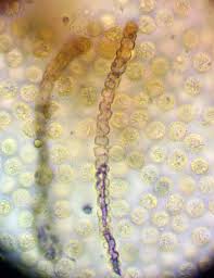 Attēlu rezultāti vaicājumam “Lycogala cf. fossiculatum macro”