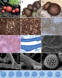 Attēlu rezultāti vaicājumam “Lycogala confusum spores”