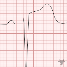 Image result for  ^ L V [ h    