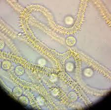 Attēlu rezultāti vaicājumam “Trichiaceae, Hemitrichiaceae, Arcyriaceae”