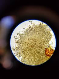 Attēlu rezultāti vaicājumam “Arcyria minuta stalked”