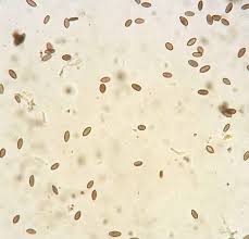 Attēlu rezultāti vaicājumam “Chaenotheca brunneola”