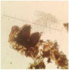 Attēlu rezultāti vaicājumam “Stemonitopsis aequalis (var. aequalis) spores”