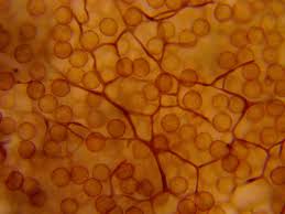 Attēlu rezultāti vaicājumam “Stemonitopsis hyperopta var. landewaldii spores”