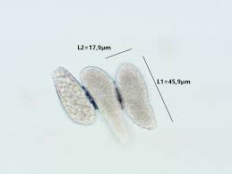 Attēlu rezultāti vaicājumam “Milesina murariae”