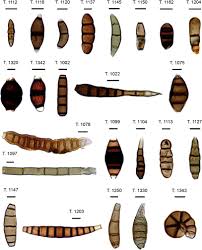 Attēlu rezultāti vaicājumam “Rosellinia desmazieri spores”