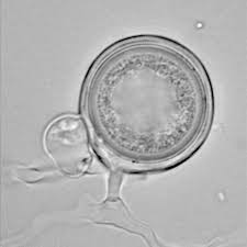 Attēlu rezultāti vaicājumam “Campylopus pyriformis sporophyte”