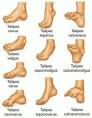 a congenital <b>deformity</b> in
