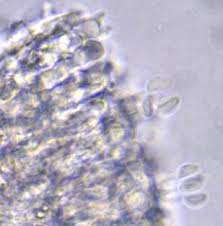 Attēlu rezultāti vaicājumam “Typhula setipes”