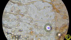 Attēlu rezultāti vaicājumam “Arcyria incarnata”