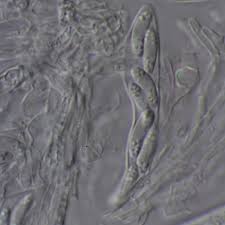 Attēlu rezultāti vaicājumam “Hyaloscypha hyalina”
