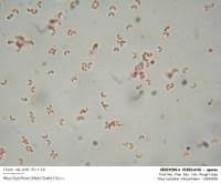 Attēlu rezultāti vaicājumam “Ceriporia viridans”