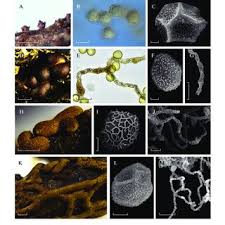 Attēlu rezultāti vaicājumam “Perichaena corticalis”