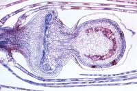 Attēlu rezultāti vaicājumam “Sphagnum sporophyte”