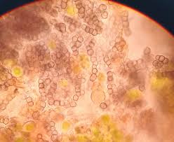 Attēlu rezultāti vaicājumam “Lichenoconium xanthoriae”