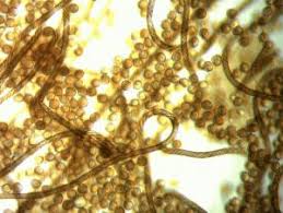 Attēlu rezultāti vaicājumam “Hemitrichia clavata spores”