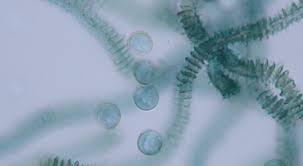 Attēlu rezultāti vaicājumam “Heterotrichia obvelata (syn. Arcyria obvelata) stalked”