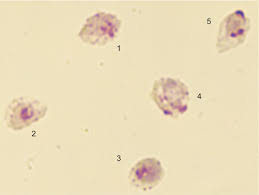Attēlu rezultāti vaicājumam “Enteridium variabile plasmodium”