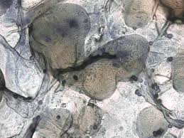 Attēlu rezultāti vaicājumam “Lycogala succineum sessile”