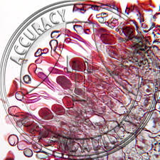 Attēlu rezultāti vaicājumam “Puccinia poarum”