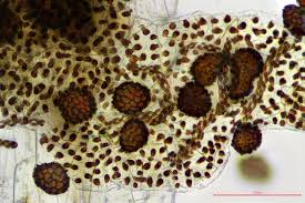 Attēlu rezultāti vaicājumam “Fossombronia foveolata sporophyte”