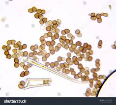 Attēlu rezultāti vaicājumam “Tranzschelia pruni-spinosae spores”