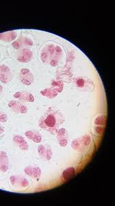 Attēlu rezultāti vaicājumam “Allium cepa bud”