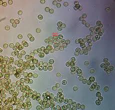 Attēlu rezultāti vaicājumam “Hemitrichia chrysospora young”