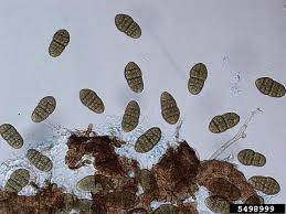 Attēlu rezultāti vaicājumam “Stemonitopsis aequalis var. microspora”