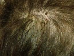 Attēlu rezultāti vaicājumam “Trichia erecta spores”