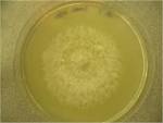 File:<b>Verticillium</b> plate.png