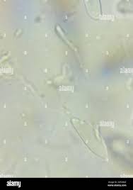 Attēlu rezultāti vaicājumam “Cudoniella acicularis”