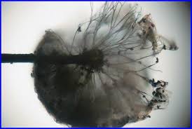 Attēlu rezultāti vaicājumam “Lamproderma gulielmae spores”