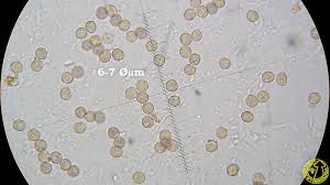 Attēlu rezultāti vaicājumam “Comatricha tenerrima spores”