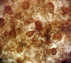 Attēlu rezultāti vaicājumam “Lycogala ustulatum”