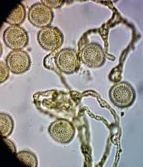 Attēlu rezultāti vaicājumam “Perichaena corticalis sessile”