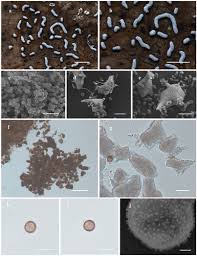 Attēlu rezultāti vaicājumam “Physarum bryomacrocarpum spores”