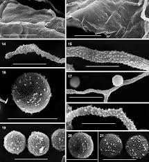 Attēlu rezultāti vaicājumam “Physarum licheniforme spores”