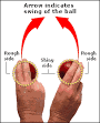 the air while an inswinger