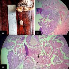 Attēlu rezultāti vaicājumam “Diderma radiatum young”