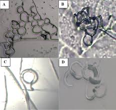 Attēlu rezultāti vaicājumam “Badhamiopsis macrospora spores”