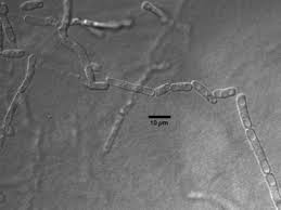 Attēlu rezultāti vaicājumam “Trichia longipalpis spores”