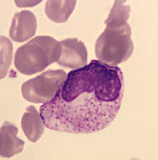 Image result for Autopheresis C