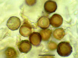 Attēlu rezultāti vaicājumam “Cribraria costata spores”