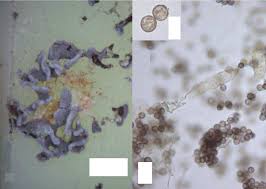 Attēlu rezultāti vaicājumam “Didymium annulisporum spores”